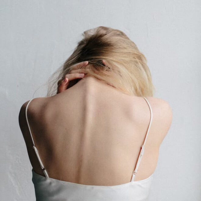 After image